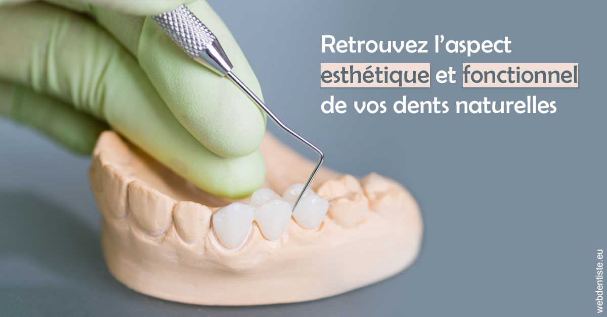 https://dr-pointeau-lafond-delphine.chirurgiens-dentistes.fr/Restaurations dentaires 1