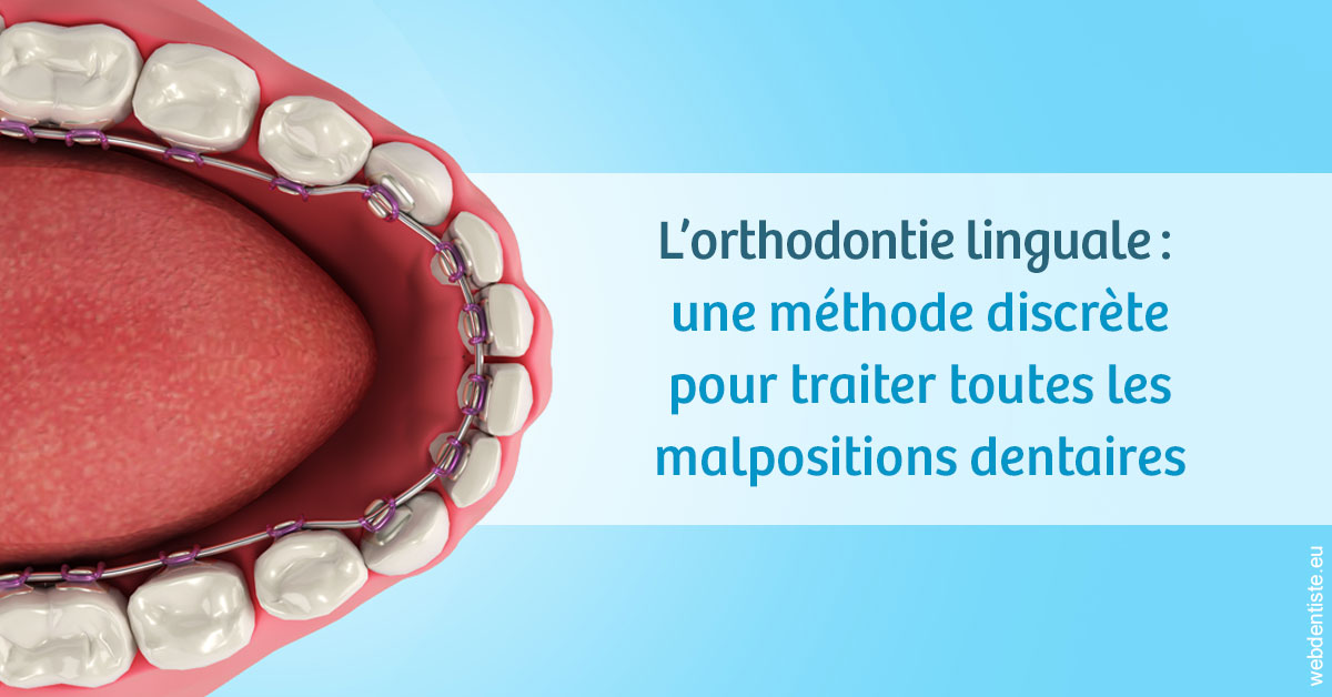 https://dr-pointeau-lafond-delphine.chirurgiens-dentistes.fr/L'orthodontie linguale 1
