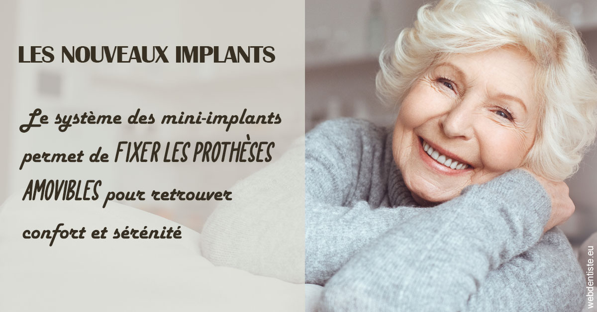 https://dr-pointeau-lafond-delphine.chirurgiens-dentistes.fr/Les nouveaux implants 1