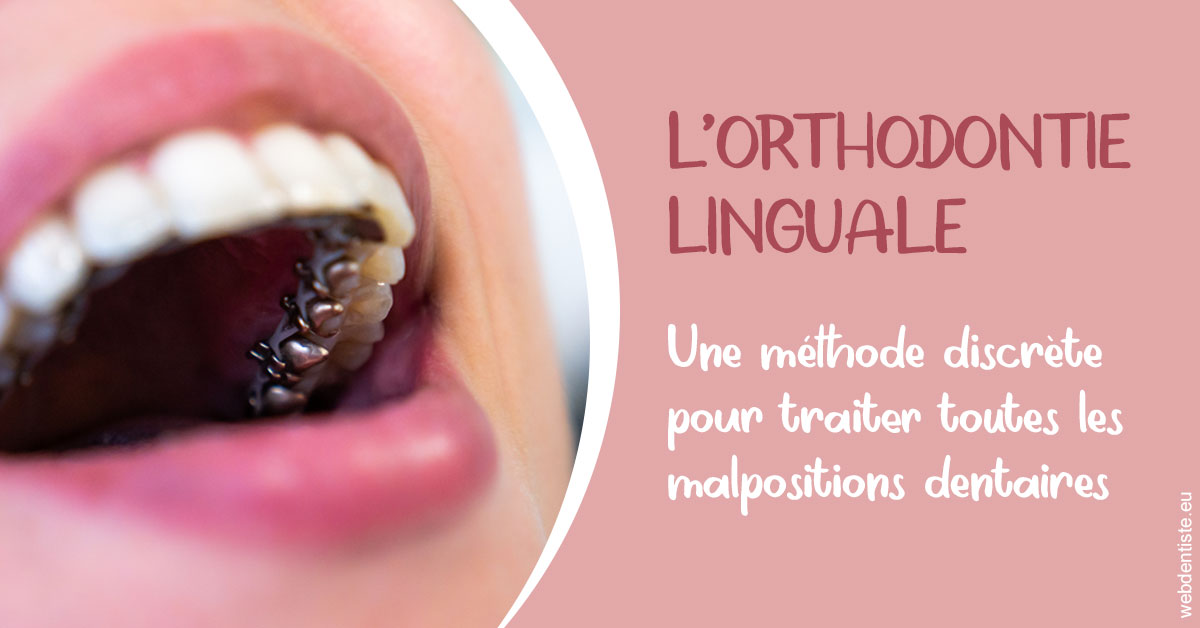 https://dr-pointeau-lafond-delphine.chirurgiens-dentistes.fr/L'orthodontie linguale 2