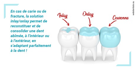 https://dr-pointeau-lafond-delphine.chirurgiens-dentistes.fr/L'INLAY ou l'ONLAY