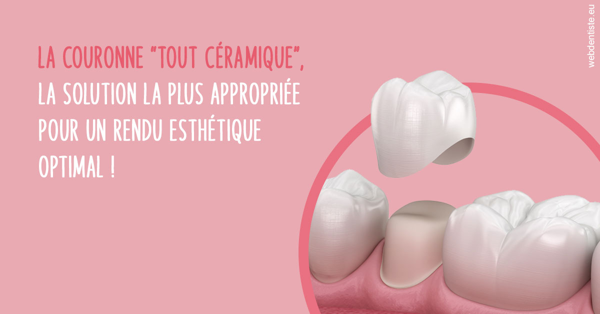 https://dr-pointeau-lafond-delphine.chirurgiens-dentistes.fr/La couronne "tout céramique"
