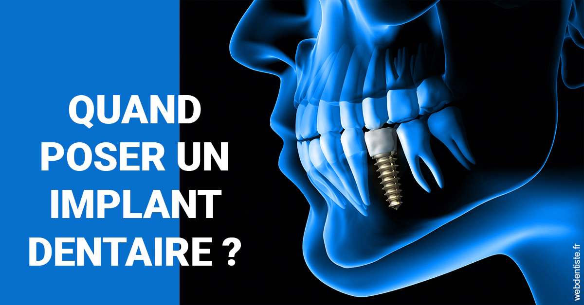 https://dr-pointeau-lafond-delphine.chirurgiens-dentistes.fr/Les implants 1
