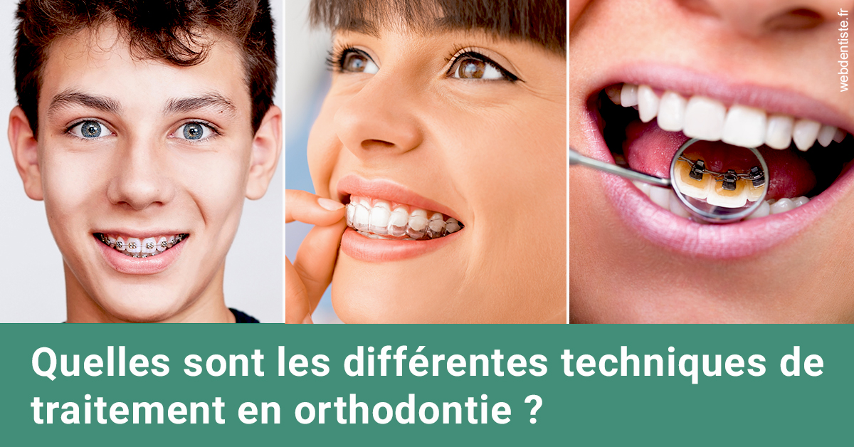 https://dr-pointeau-lafond-delphine.chirurgiens-dentistes.fr/Les différentes techniques de traitement 2