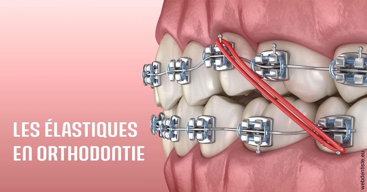https://dr-pointeau-lafond-delphine.chirurgiens-dentistes.fr/Elastiques orthodontie 2