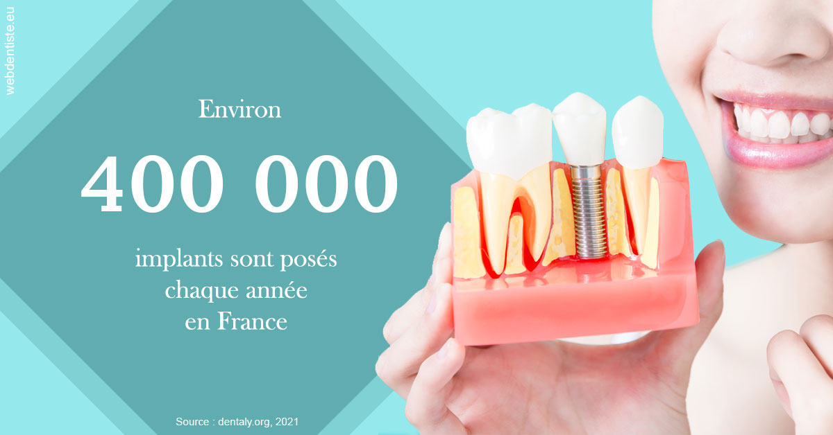 https://dr-pointeau-lafond-delphine.chirurgiens-dentistes.fr/Pose d'implants en France 2